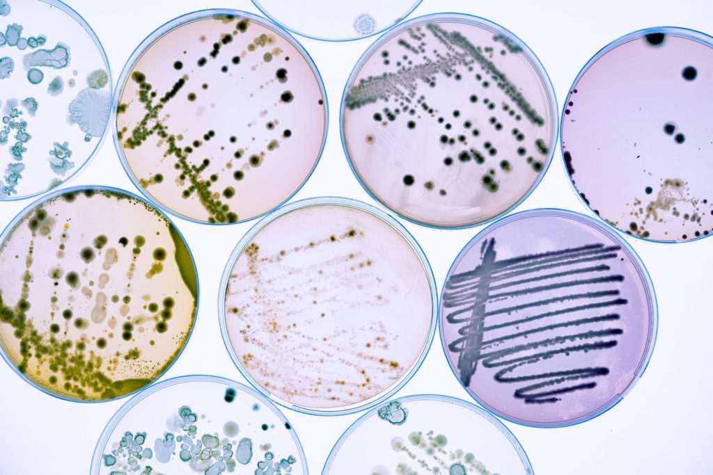 Bacteria Colonies and Fungus in Various Petri Dish